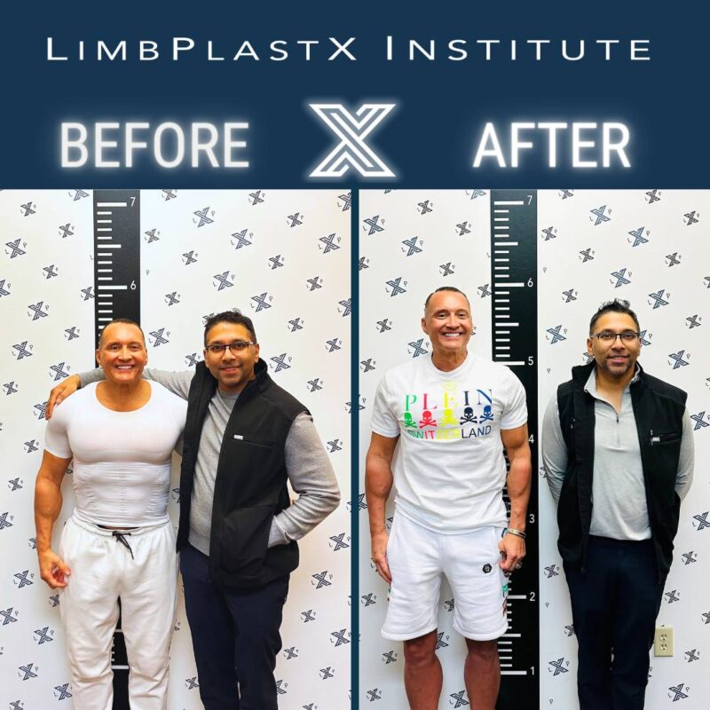 leg lengthening surgery near me